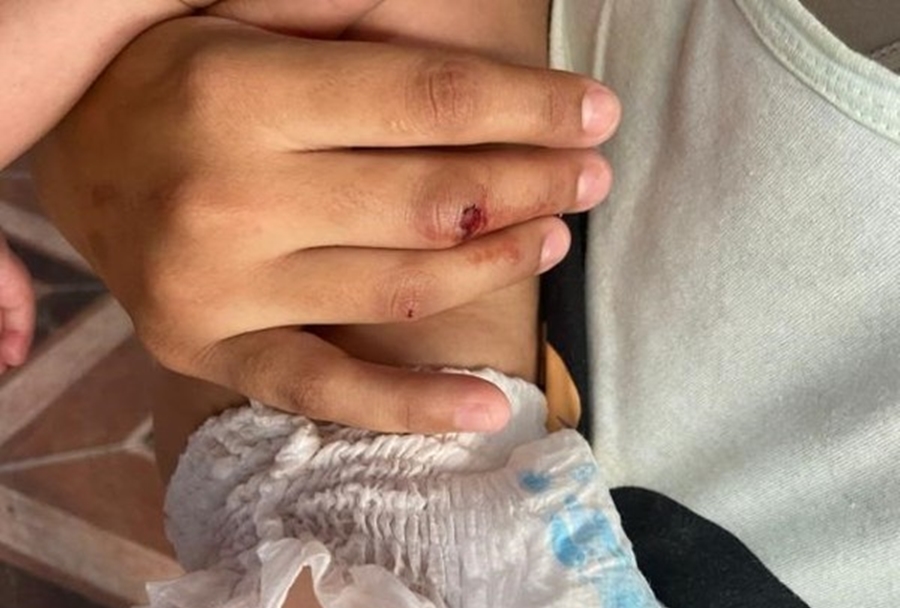 AMAMENTANDO: Após separação, esposa é agredida com bebê no colo pelo ex