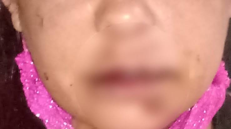 DENTRO DE CASA: Cabeleireira é atacada com socos no nariz por marido que chegou descontrolado