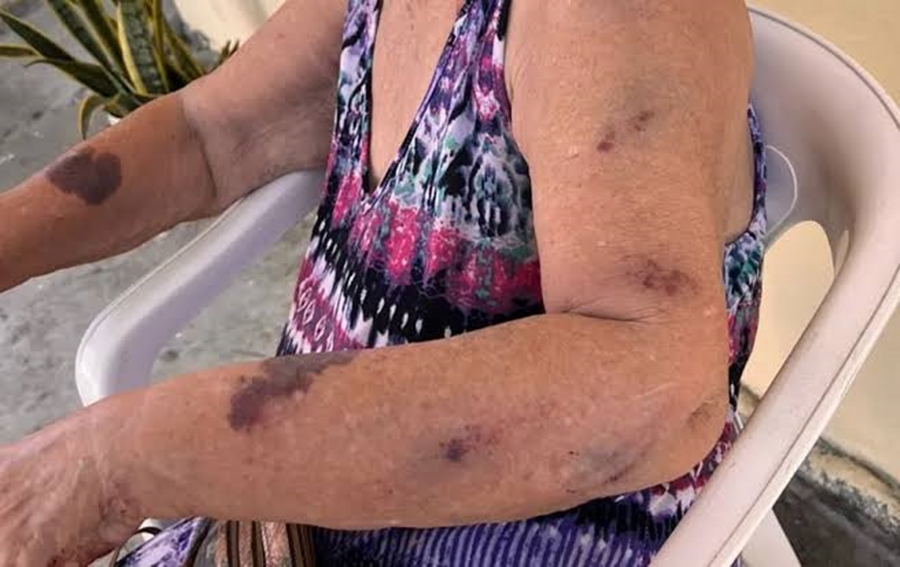 REVOLTANTE: Filho é acusado de invadir residência e atacar a mãe de 58 anos