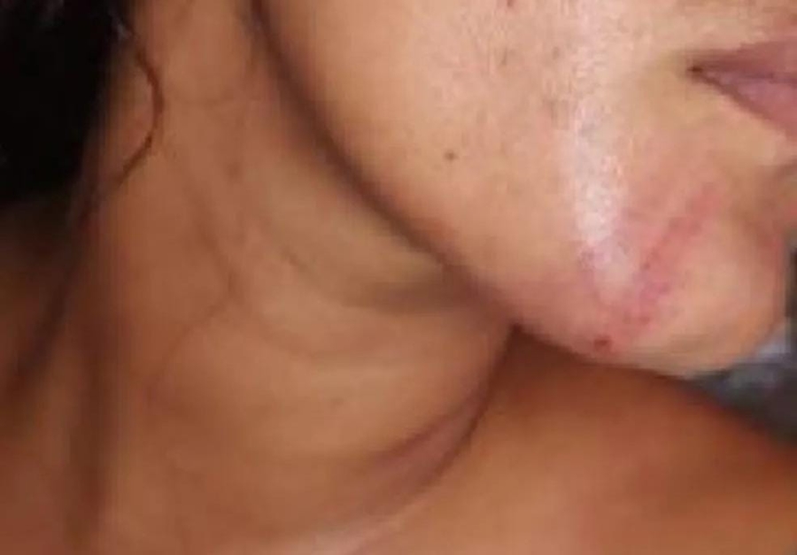 FURIOSO: Venezuelano espanca e ameaça assassinar mulher ao descobrir traição