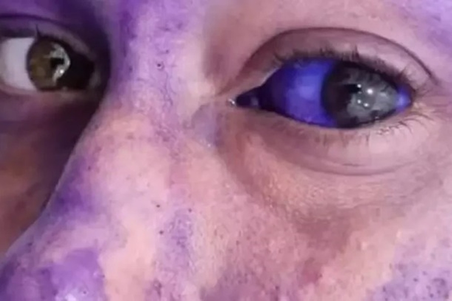 VIOLÊNCIA: Universidade se pronuncia após trote com mistura tóxica, em Cacoal