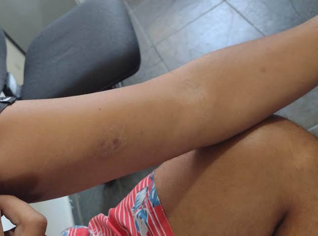 ACABOU: Mulher é espancada pelo ex-marido ao tentar reconciliação 