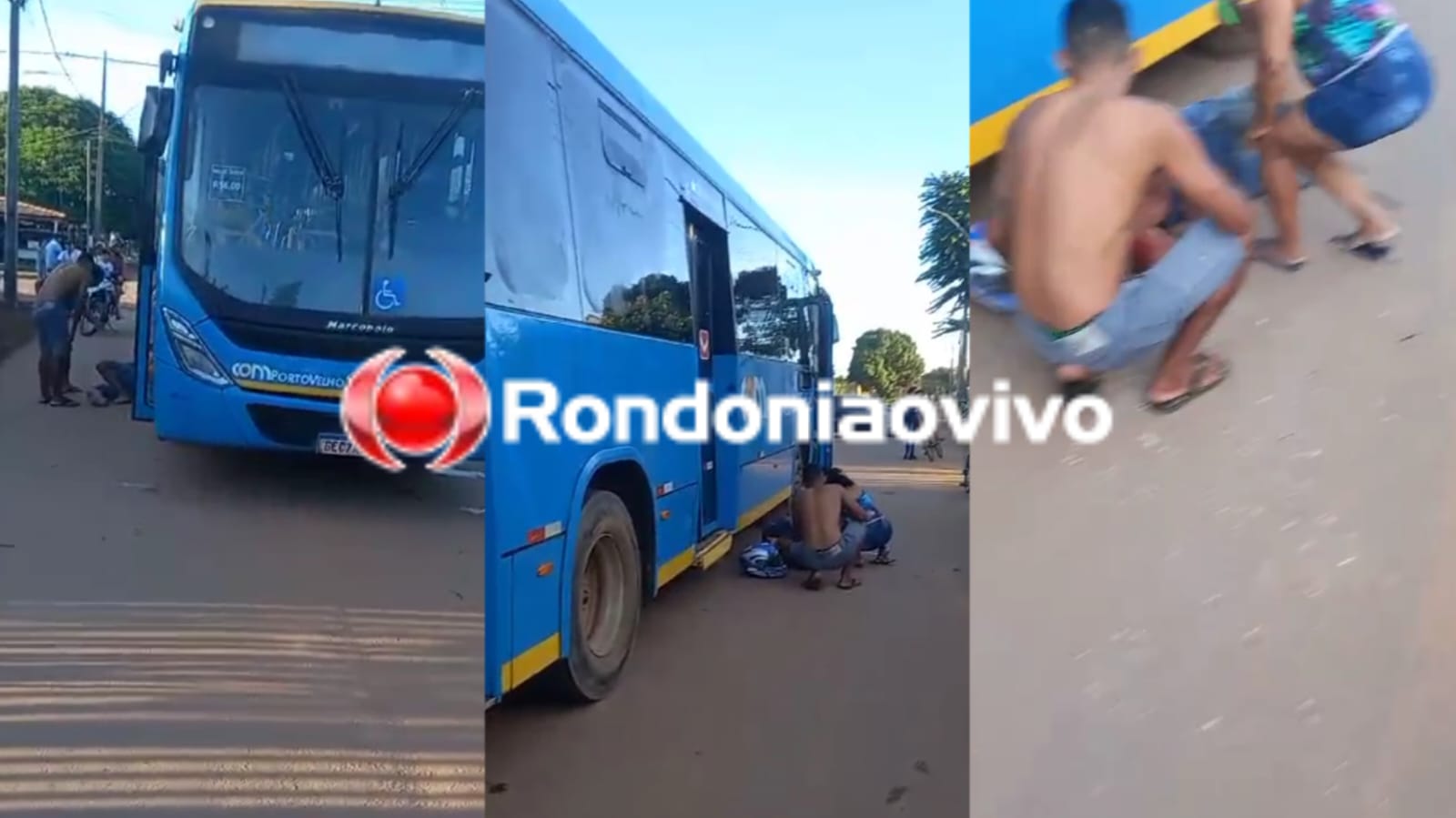 URGENTE: Motociclista sofre grave fratura exposta ao ser atropelado por ônibus