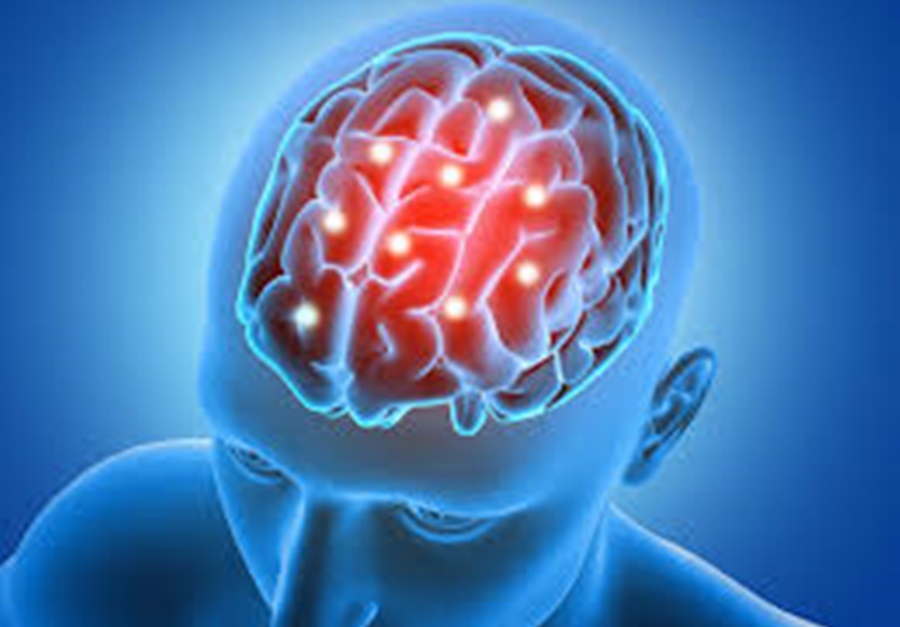 SAÚDE E BEM ESTAR: Esclerose Múltipla sintomas, causas e tratamento