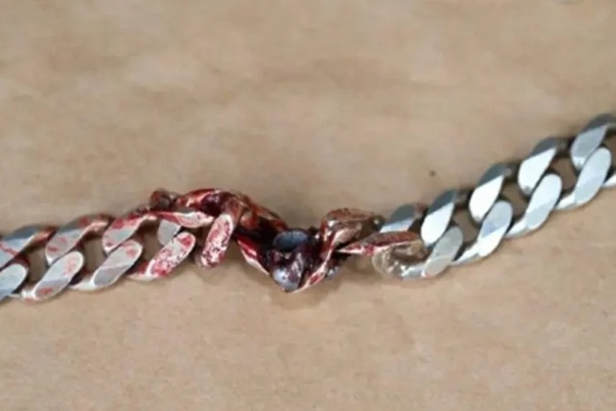 SORTE: Homem toma tiro e é salvo por corrente que usava no pescoço