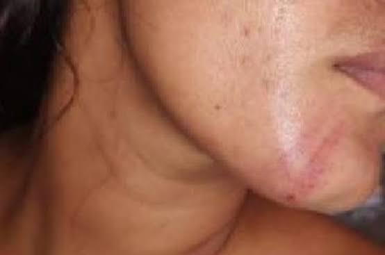 VIOLÊNCIA DOMÉSTICA: Sogra aciona polícia para prender genro que agrediu esposa em casa