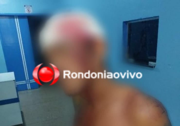 TENTATIVA DE HOMICÍDIO: Homem é atacado na cabeça por trio após desavença entre vizinhos 