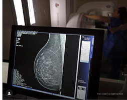 SAÚDE DA MULHER: Lula sanciona lei que amplia mamografia no SUS para mulheres acima de 40 anos