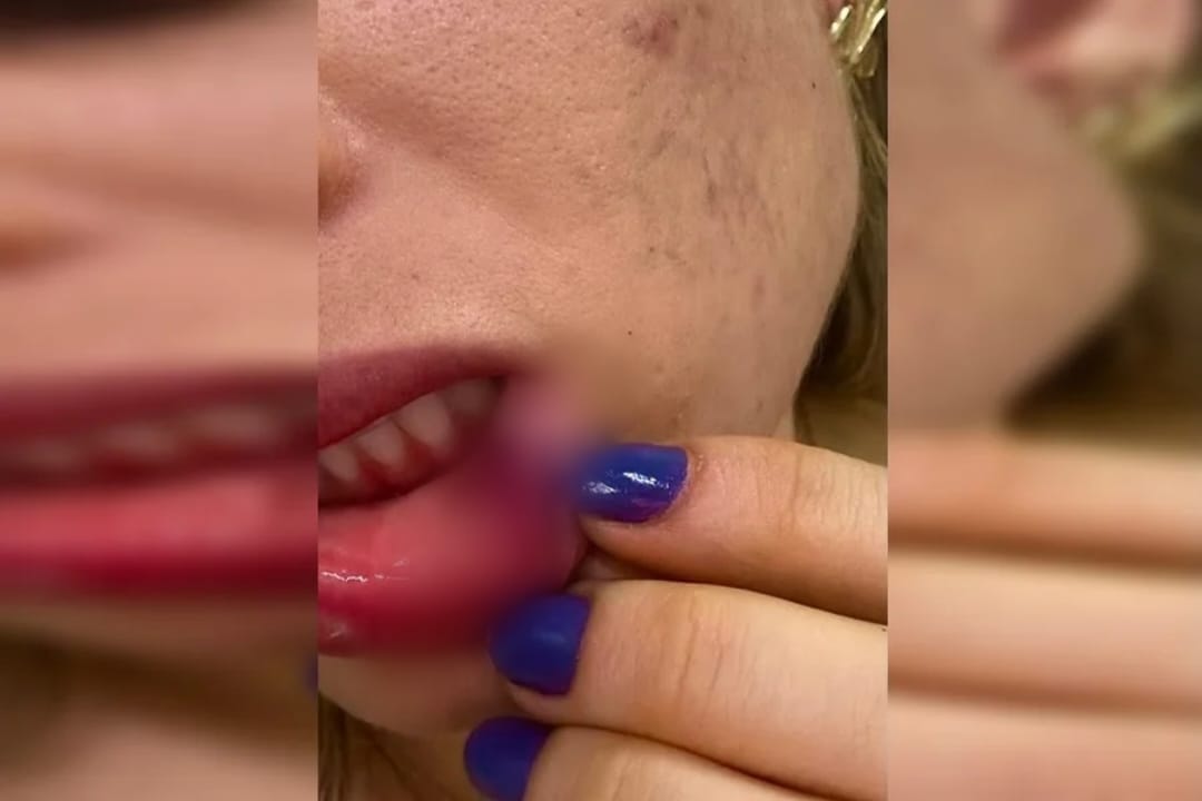 MARIA DA PENHA: Venezuelano foge após agredir esposa boliviana na zona Sul 