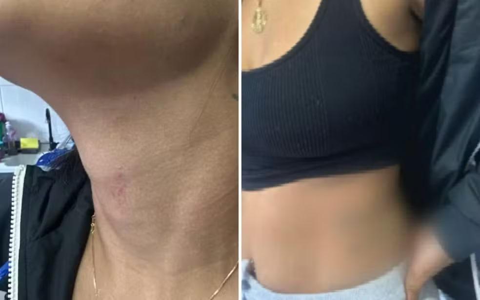 LEU MENSAGENS: Marido enciumado agride esposa e arranca brinco da orelha dela