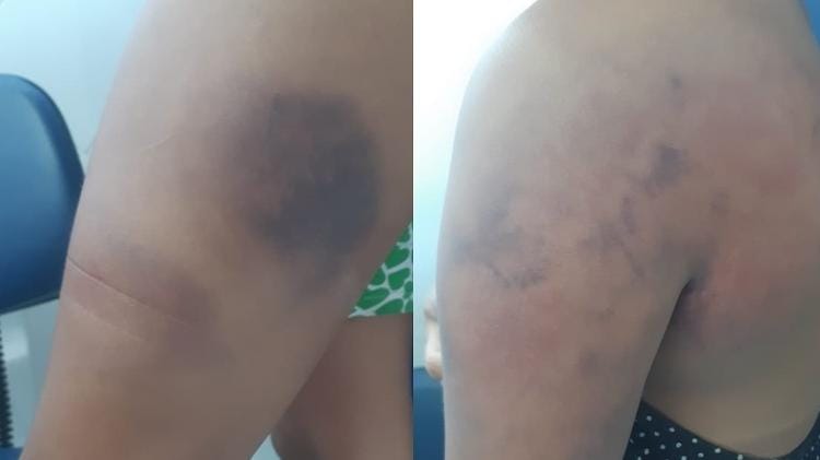 APÓS BEBEDEIRA: Jovem é socorrida para a UPA após ser atacada pelo marido