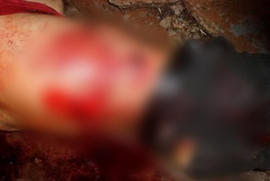 ATENTADO: Adolescente leva facada ao questionar homem que o encarava