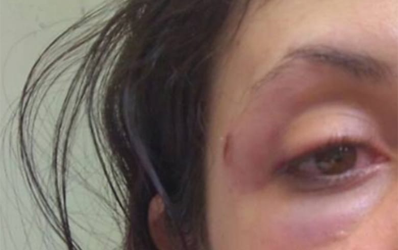 SOCOS NO ROSTO: Esposa é agredida pelo marido por questionar ele de chegar tarde em casa