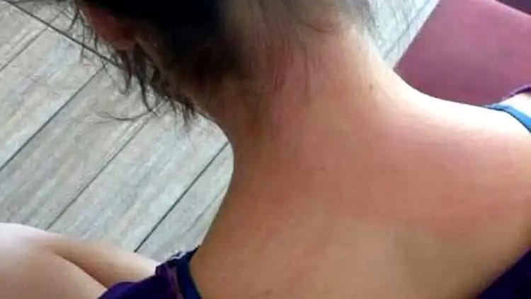 AGRESSOR FUGIU: Adolescente é atacada a pauladas pelo marido após discussão em apartamento