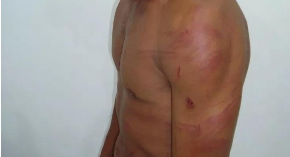 ENFURECIDA: Jovem com a namorada tem casa invadida e é surrado por ex-mulher na capital