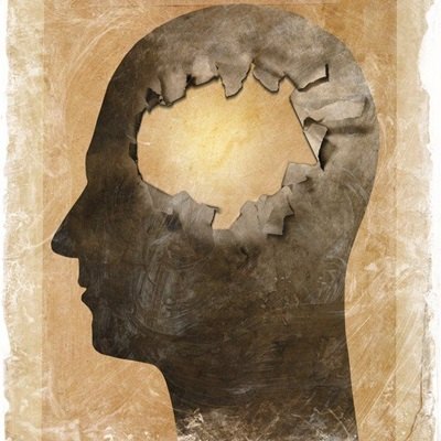 Síndrome que faz pensar que está morto