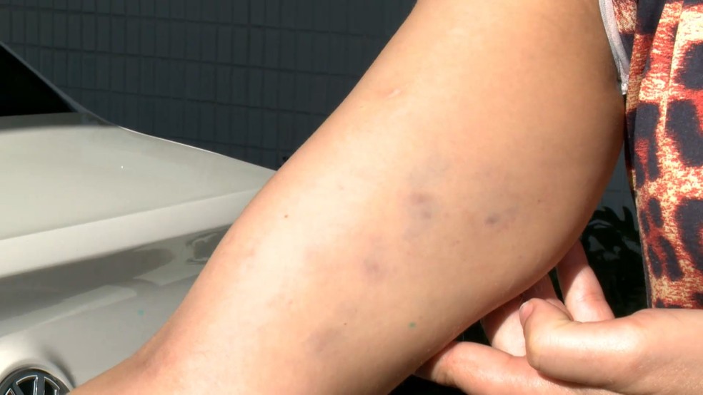 'VALENTÃO': Mulher tem residência invadida e é surrada pelo ex-marido 