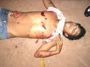 Álcool - Jovem leva sete facadas em bebedeira - imagem de forte impacto