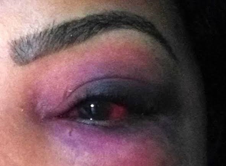 FURIOSO: Ex-marido invade residência, espanca mulher e toma criança do colo dela