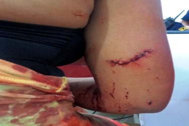 Mulher vai atender porta de residência e quase é morta a facadas pelo ex-marido 
