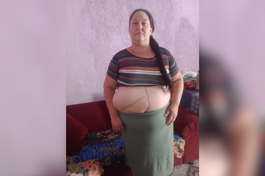 PEDIDO DE AJUDA: Mãe solteira organiza vaquinha para cirurgia de retirada de hérnia