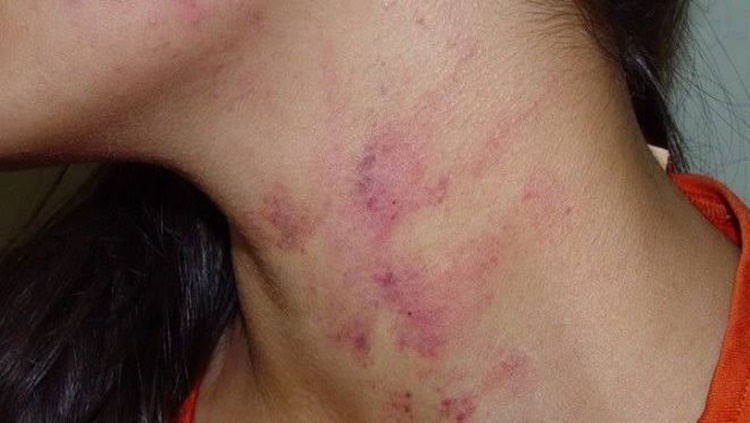 EMBRIAGADO: Homem amanhece na bebedeira e chega em casa agredindo a esposa