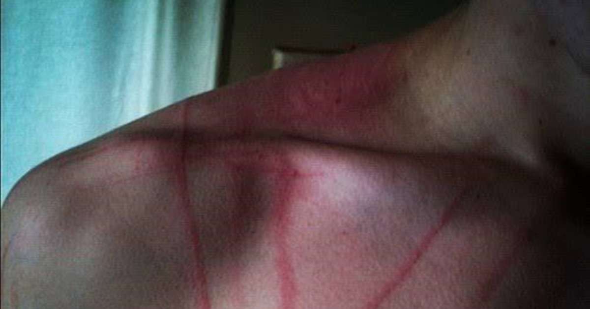 ACOSTUMADA: Mulher tenta destruir carro e espanca ex-marido com tapas e mordidas