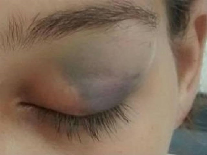 POR AMOR: Esposa agredida não deseja ver marido preso e recusa fazer denúncia