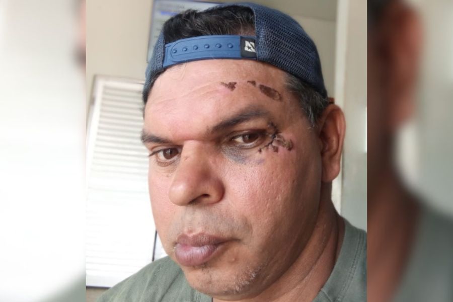 FALTA DE ACESSIBILIDADE: Calçadas continuam sendo um grande obstáculo para pessoas com deficiência