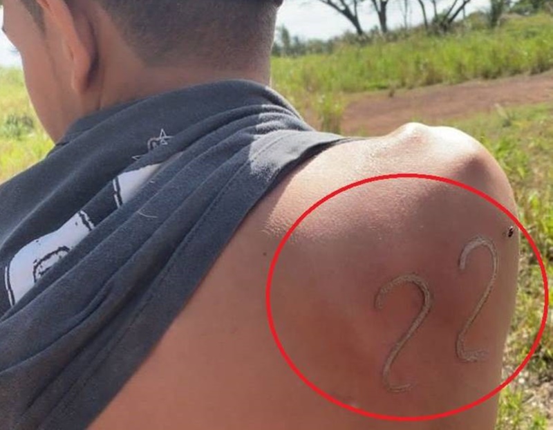 VIDA DE GADO: Com ferro em brasa, garoto de 17 anos tatua 22 nas costas