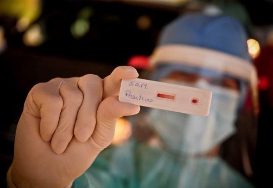 BOLETIM COVID: Mais de 90 pessoas estão internadas em rede pública de RO