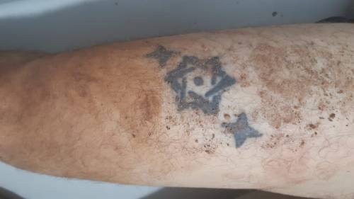 MISTÉRIO: Polícia tenta identificar corpo tatuado de rapaz morto a pauladas