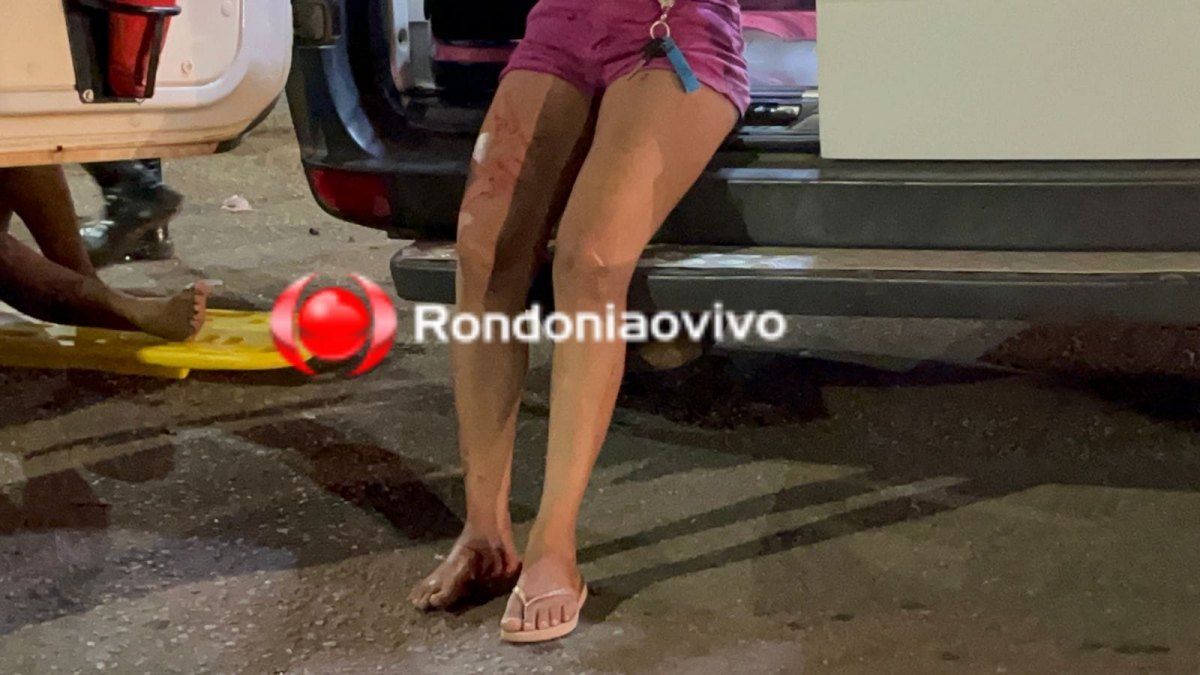 URGENTE: Quatro pessoas sofrem ferimentos após colisão entre motos na BR-364 