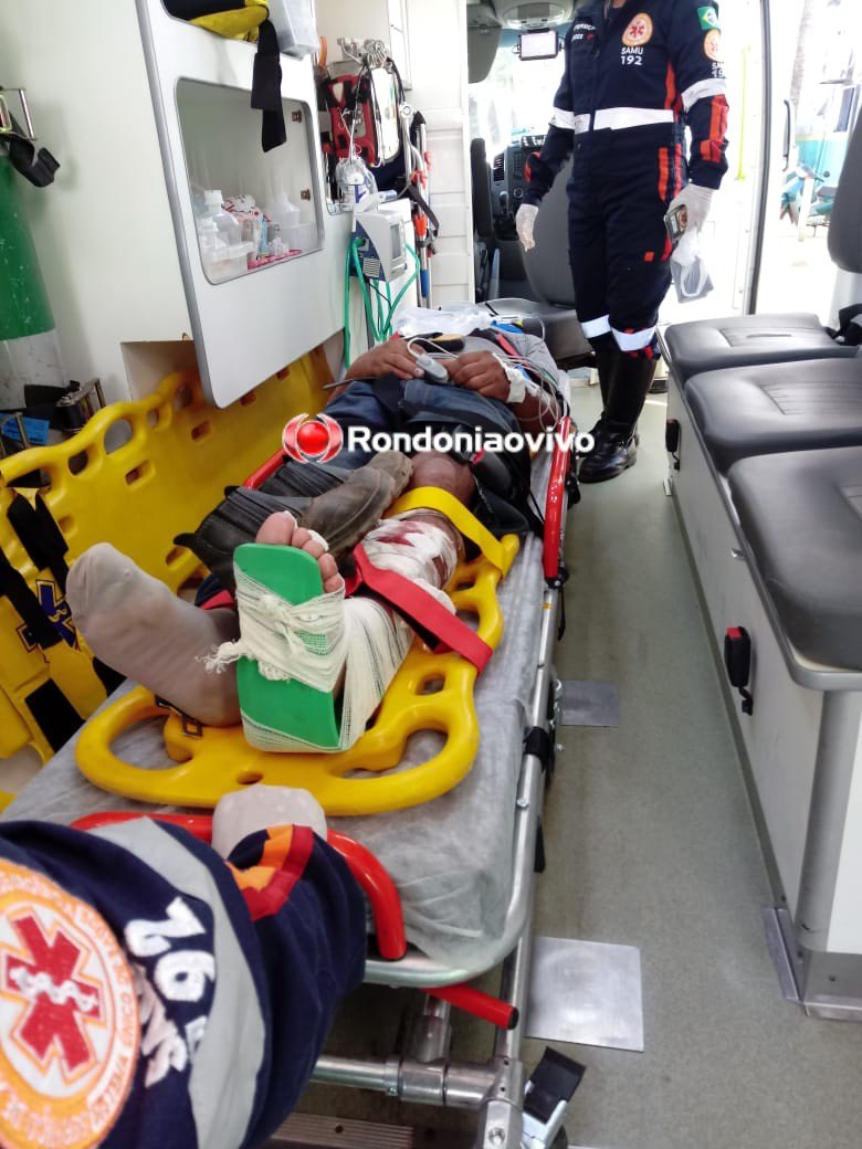 IMPRUDÊNCIA NO TRÂNSITO: Mais um motociclista sofre fratura exposta na perna em grave acidente