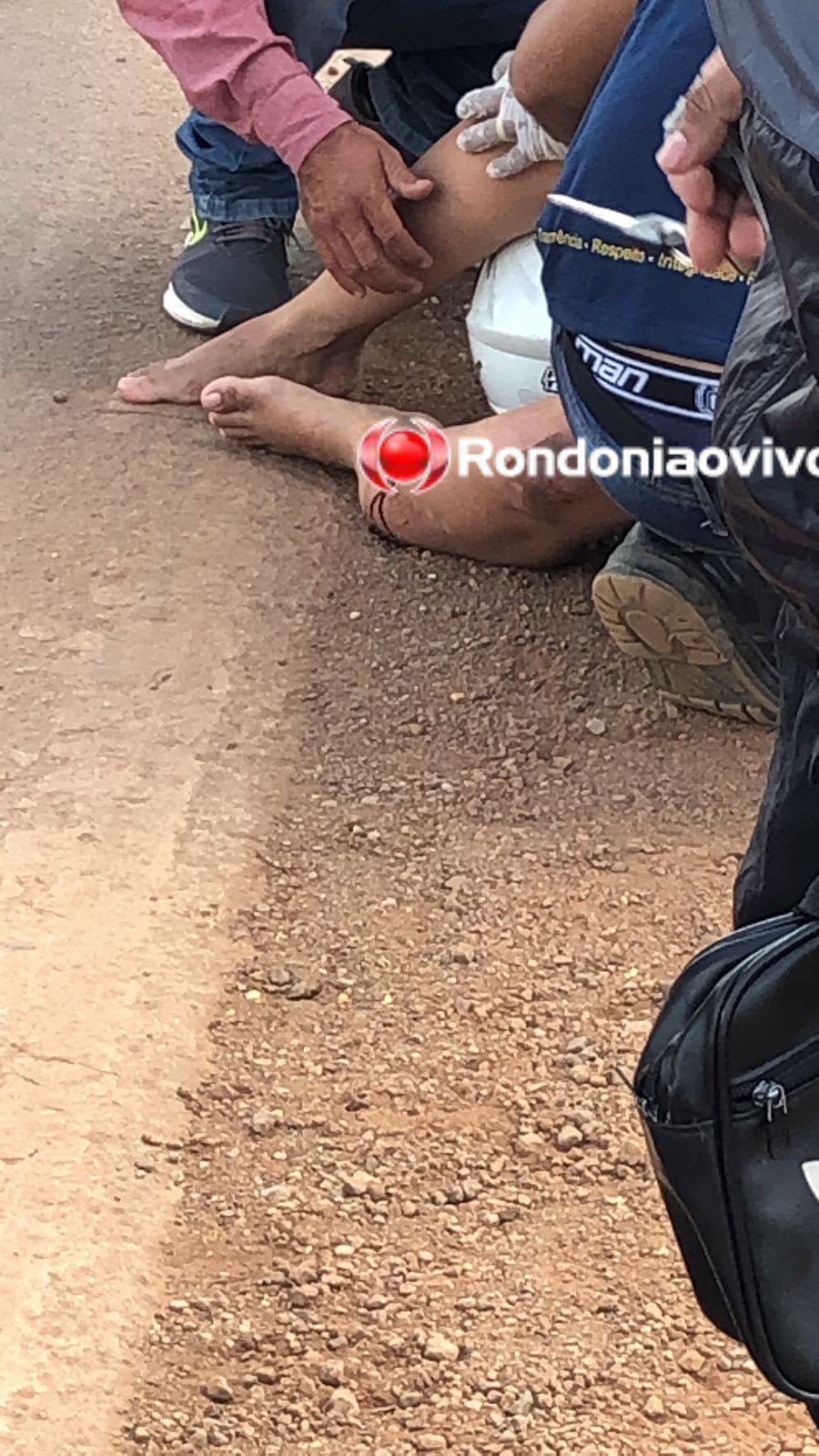 MOTOCICLETA: Mulher sofre grave acidente na BR-364 em frente ao Atacadão