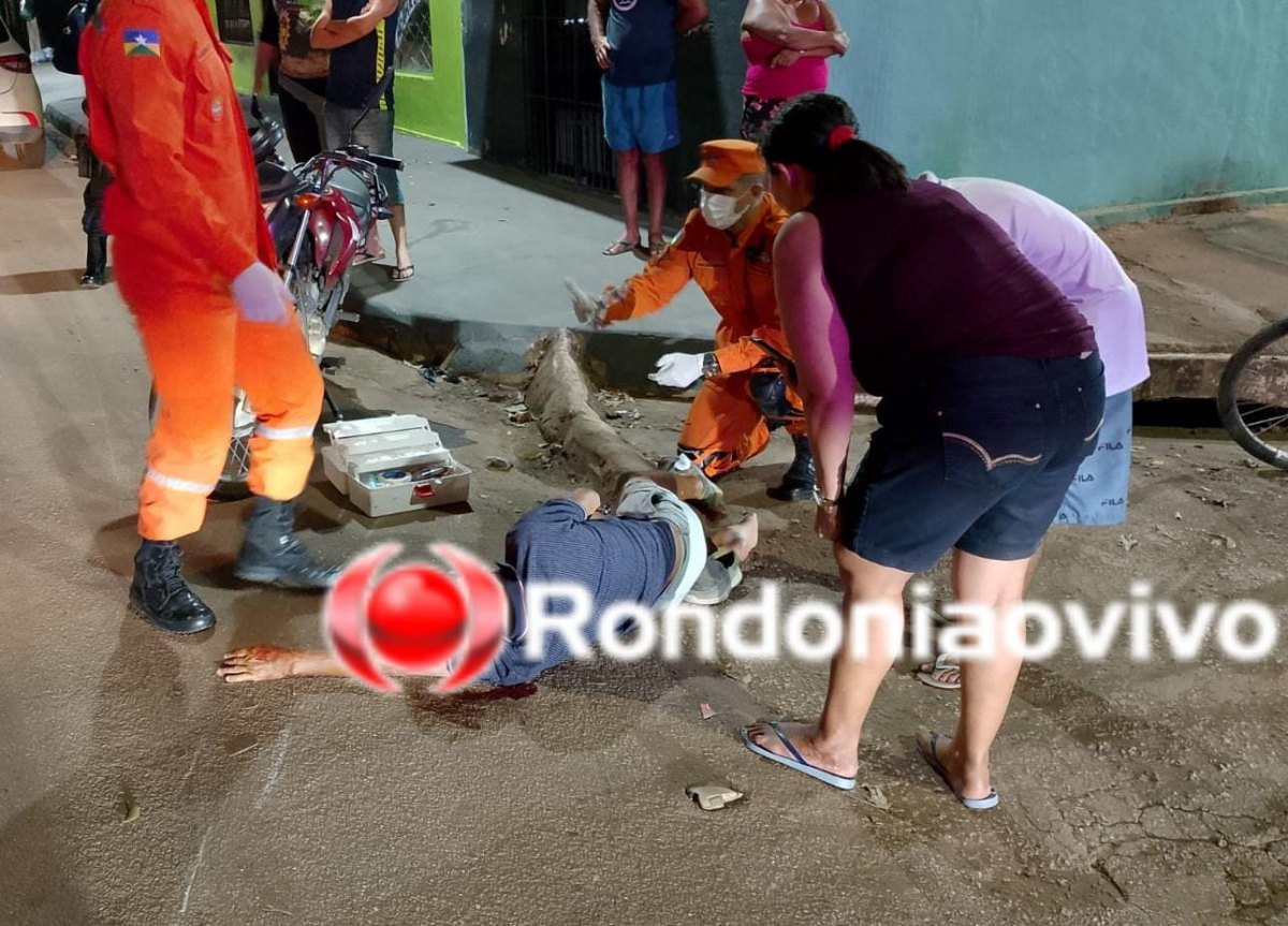 NA MAMORÉ: Motociclista de 66 anos sofre grave fratura exposta em acidente 