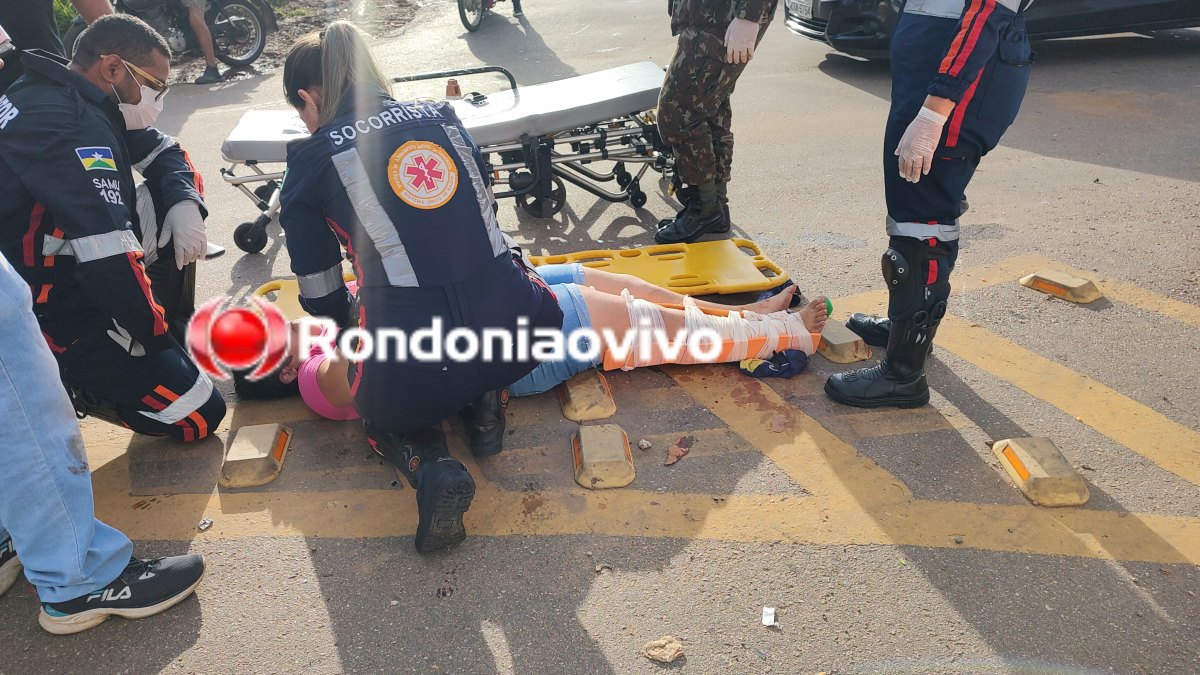 NA ROTATÓRIA: Motociclista sofre grave lesão na perna em acidente próximo ao 5° Bec