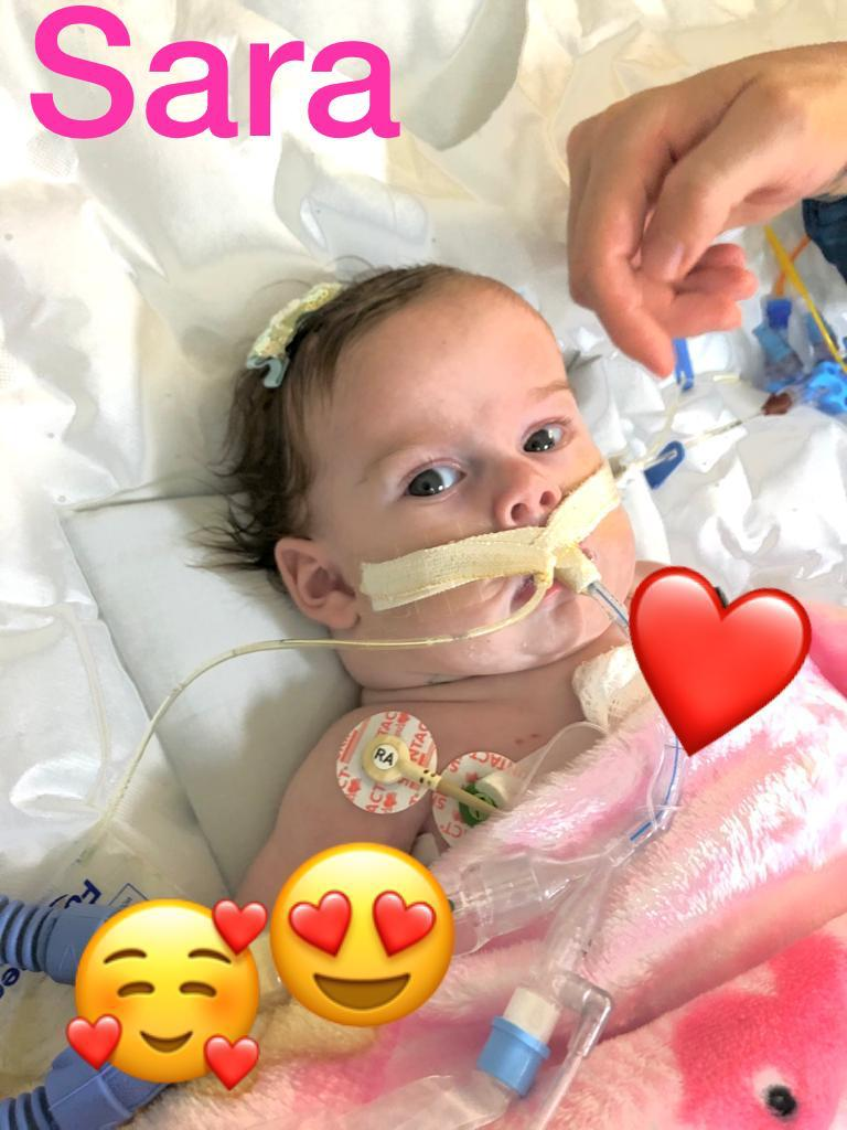 ALEGRIA: Casal de RO comemora cirurgia de separação de filhas siamesas