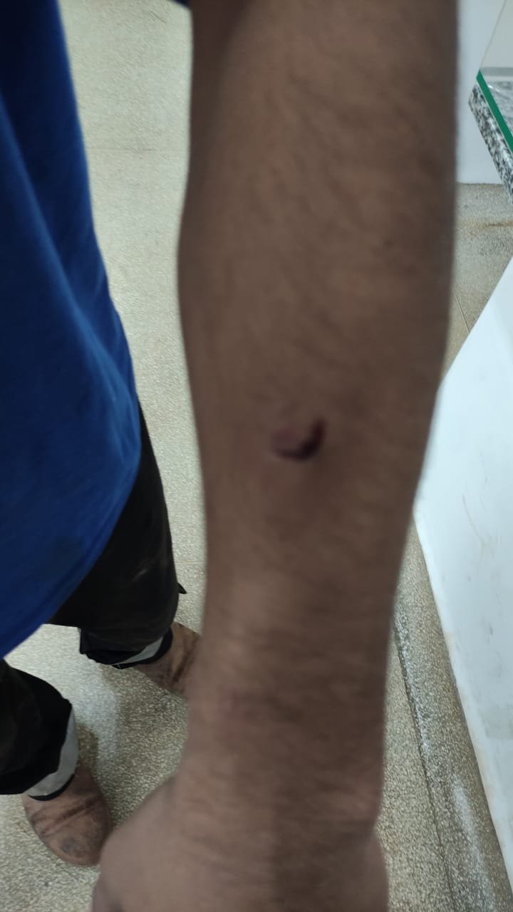 COLETA DE LIXO:  Empresa RLP clama por conscientização da comunidade sobre os cuidados com os cães