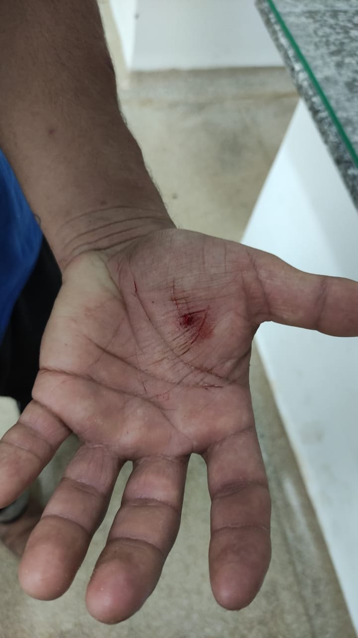 COLETA DE LIXO:  Empresa RLP clama por conscientização da comunidade sobre os cuidados com os cães