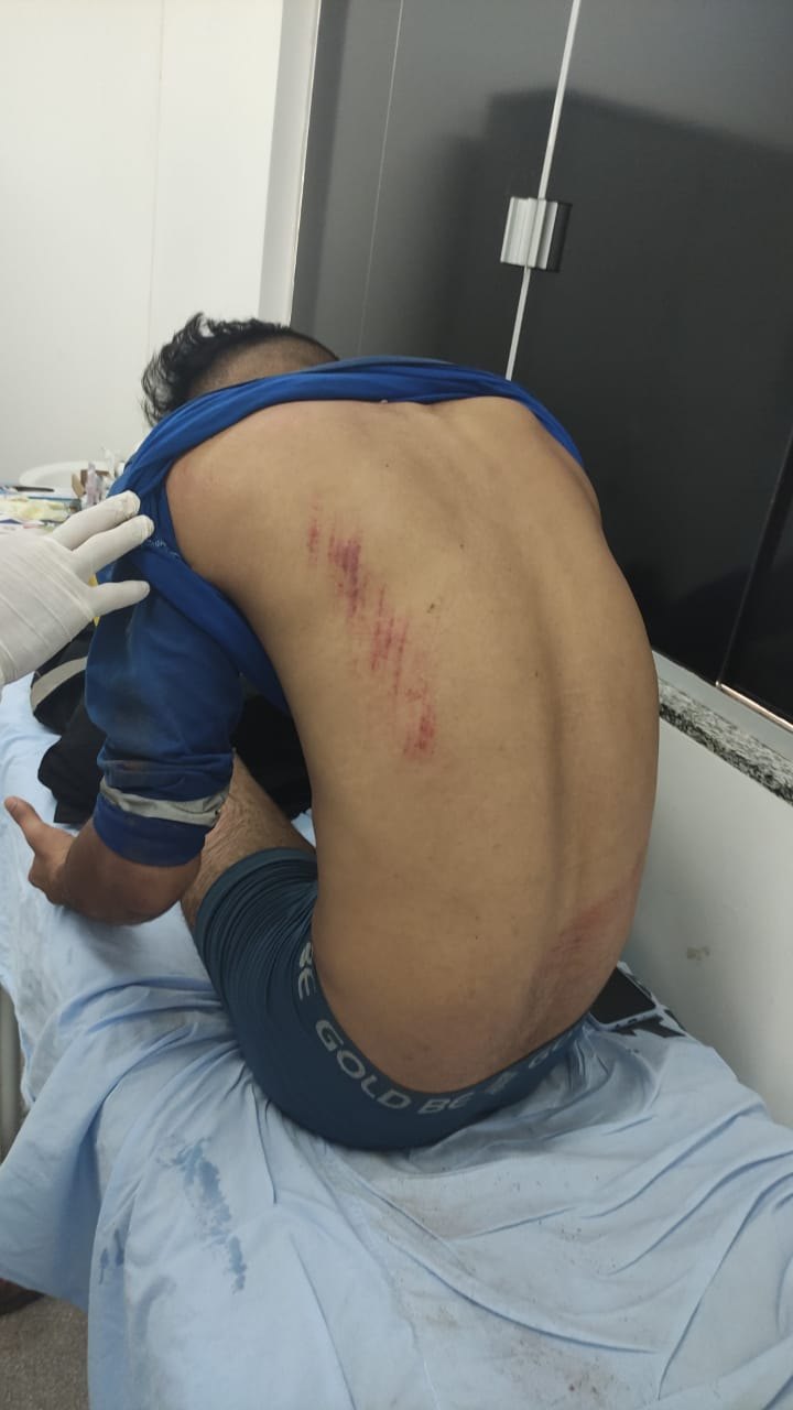 COLETA DE LIXO:  Empresa RLP clama por conscientização da comunidade sobre os cuidados com os cães