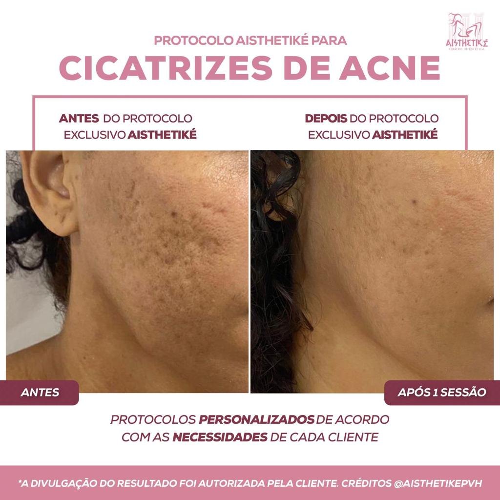 ESPECIAL DE JANEIRO: Confira as promoções imperdíveis da Clínica Aisthetiké 