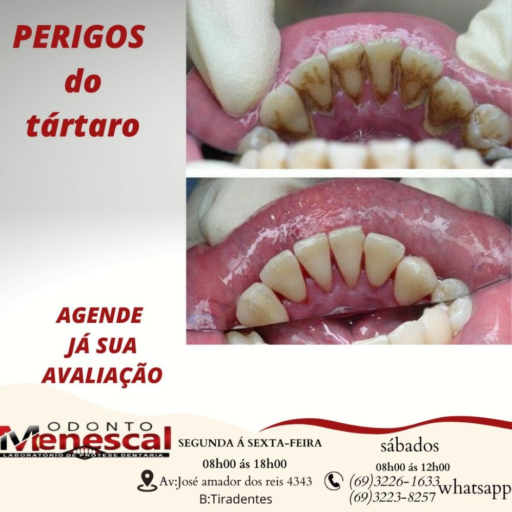 Venha conhecer os serviços personalizados da Clínica Odonto Menescal