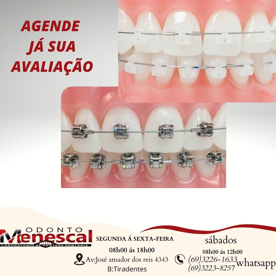 Venha conhecer os serviços personalizados da Clínica Odonto Menescal