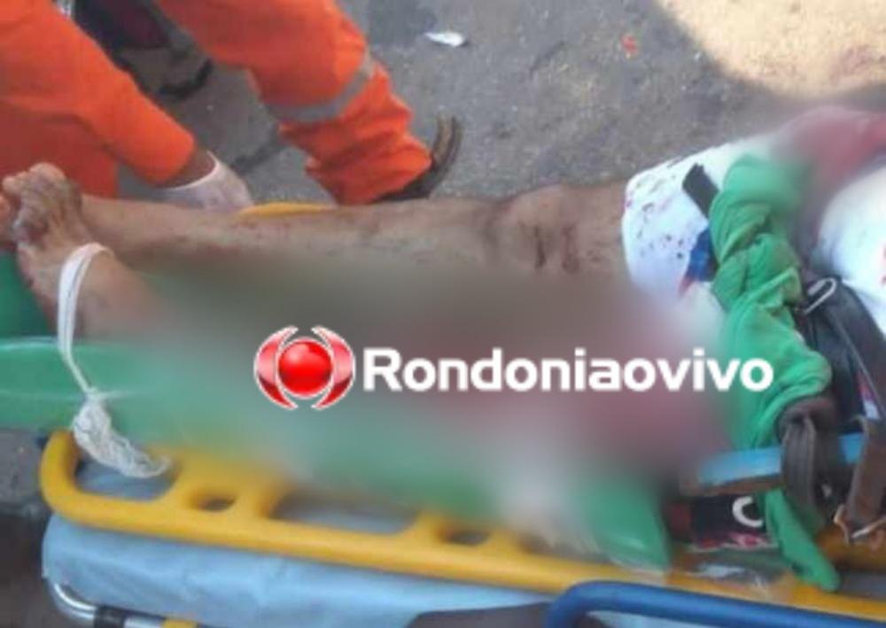 TRÁGICO: Cabeleireiro vítima de grave acidente teve que amputar a perna no hospital