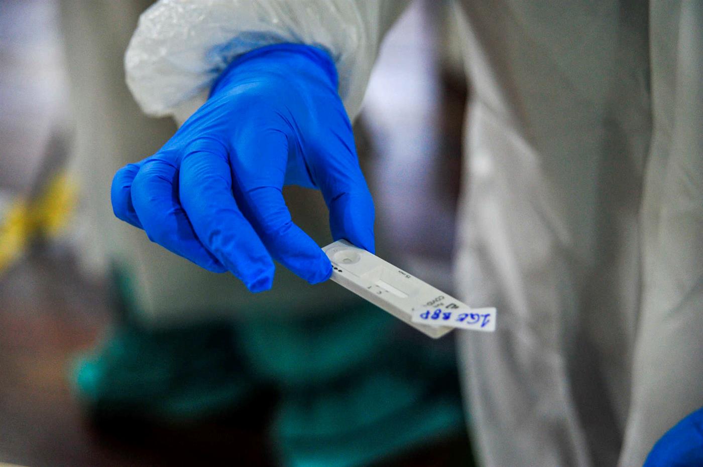 PANDEMIA: Boletim aponta mais 1.631 casos e duas mortes por covid-19 em Rondônia