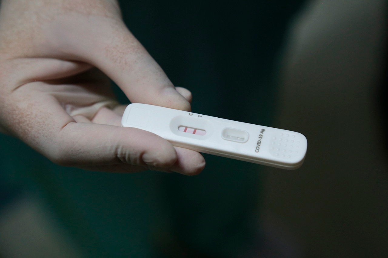 COVID-19: Mais uma morte e 1.039 casos registrados em Rondônia, aponta Agevisa