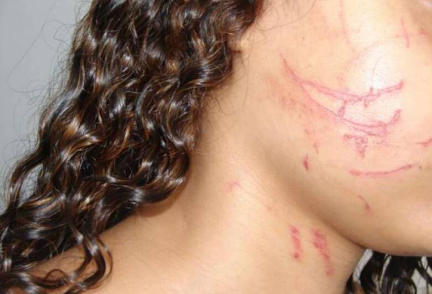 BRUTALIDADE: Vereador é acusado de espancar a nora por causa do filho