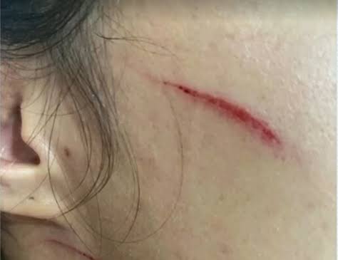 DESNATURADA: Filha é presa por agredir a mãe com socos e pauladas no Orgulho 