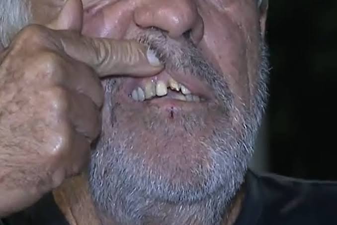 NO ALPHAVILLE: Homem de 58 anos tem dente quebrado ao ser agredido e roubado por criminosos 